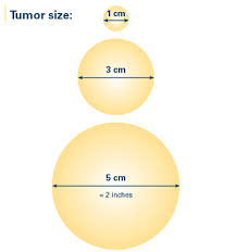 size of the breast cancer breastcancer org