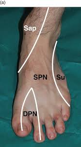 Image result for Probe-to-Bone Test