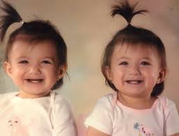 Fingerprints formed by random fetal movements