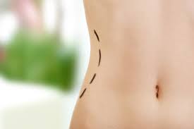Their fabrics are mostly made of cotton so irritation will not if we use the washing machine, we could alter its shape and fabrics. How Long Do I Have To Wear My Faja Pain Swelling Solutions