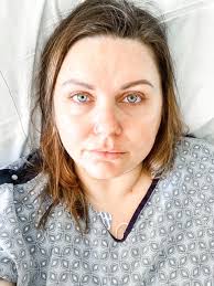 How Weight Loss Surgery And Walking Helped Me Lose 125 Pounds'