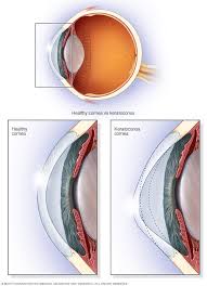 Image result for Cornea