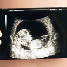 12 week pregnancy dating scan: Nuchal Translucency Scan