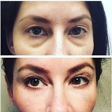 Helen Satterfield (hlsatterfield)