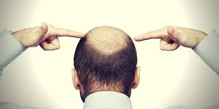 Azelaic acid side effects & safety. Azelaic Acid For Hair Loss Does This Solution Really Work
