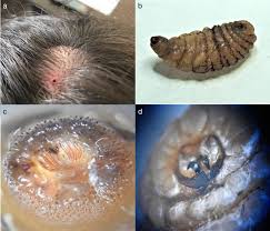 Image result for Myiasis