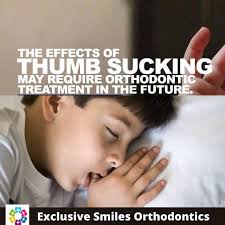 Thumb-sucking is acceptable for a teething young infant, but for children  ages five and up, with permanent teeth, it can cause an overbite or  incorrect alignment of the teeth. This may require