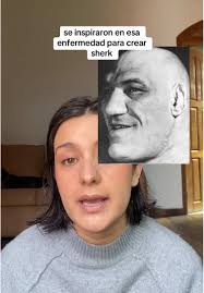 Ana Elena Perez Verdin Endocrinologa