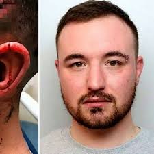 Dumped thug sliced ex-boyfriend's neck with shattered mug