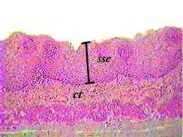 Squamous (nonkeratinized, keratinized) cuboidal columnar transitional. Stratified Squamous Non Keratinized Epithelium