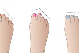 هل تعرفين أن شكل أصابع القدمين قد تقول الكثير عن الشخص؟