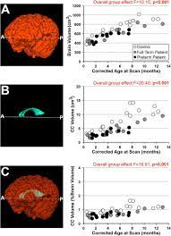Titration (also known as titrimetry and volumetric analysis) is a common laboratory method of quantitative chemical analysis to determine the concentration of an identified analyte. Corpus Callosum Volumetric Analysis Representative 3 D Renderings Download Scientific Diagram