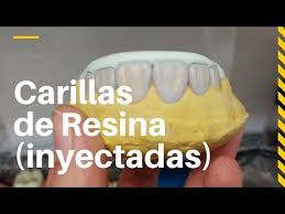 Carillas Directas Tecnica De Inyeccion Paso A Paso Parte 1 Encerado Y Duplicado De Modelo Youtube Carillas Dentales Estetica Dental Dentistas
