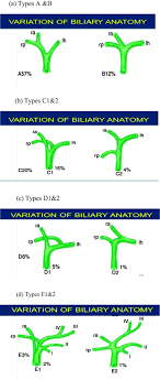 Bile is secreted by t. Biliary Tree Variations As Viewed By Intra Operative Cholangiography Comparing Egyptian Versus International Data Sciencedirect