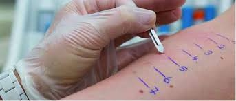 Доставка soldesam осуществляется транспортными компаниями, сроки выполнения заказа оговариваются с менеджером гуттафарм. Fzkm Alergologjia