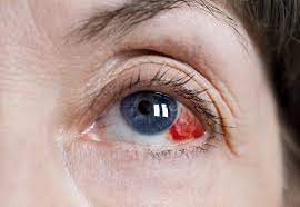Glaucoma is a leading cause of blindness for people over 60 years old. Ocular Hypertension A Precursor To Glaucoma Atlantic Eye Institute