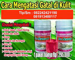 Cara Menghilangkan Gatal Kulit Eksim Di Telapak Kaki Dan Tangan Jual Obat Manjur Eksim Psoriasis Kulit