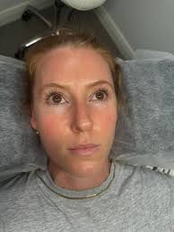 What's everyone's favorite shields to use for lash lift?