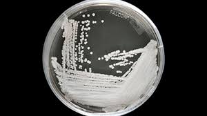 Image result for Buchnera candida