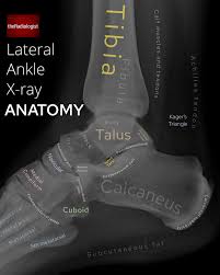 Image result for Ankle XRay