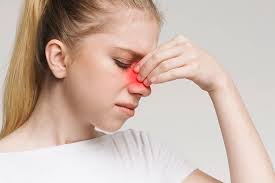 Westchester County Integrative Medicine for Allergic Rhinitis