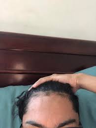 Am american mouth f g big bill, still going down. If I Buzzcut My Hair Will It Fix Those Baby Hairs On My Hairline And I Cut My Hair And He Told Me I Have A Weird Line Up And Never Realized