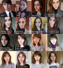 M2f transition timeline / the ultimate guide to transgender laser hair removal l e. Pin On Amazing Transformations
