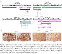 Nbc indonesia jawa barat, indonesia. Inflammatory Breast Cancer Clinical Implications Of Genomic Alterations And Mutational Profiling Document Gale Academic Onefile