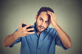 Shock loss is where there is a loss of natural hair whether it is from the donor area or the recipient area after a hair restoration. Shock Loss After Hair Transplant Longevita Hair Transplant