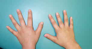 Image result for Fingerhuthia