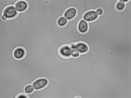 Image result for Buchnera candida