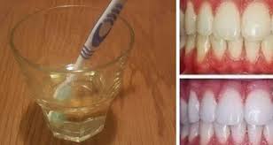 Ce Seul Ingredient Permet De Blanchir Naturellement Les Dents Blanchir Les Dents Blanchir Les Dents Naturellement Astuce Naturelle