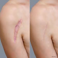 Pin On Plastic Surgery Procedures
