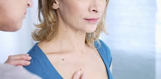 Any irregularities in behavior would be reported right away. Skin Cancer Treatment Melanoma Fort Meyers Fl Naples Fl