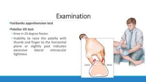 Image result for Patellar Apprehension Test