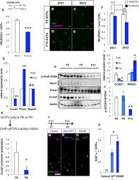 You'll see how using expressions is often faster and more adaptable. Cyclind1 Controls Development Of Cerebellar Granule Cell Progenitors Through Phosphorylation And Stabilization Of Atoh1 Biorxiv
