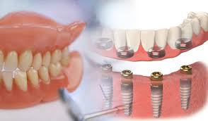 Please click the link below for a listing of dental clinics in your area. Dental Clinics Near Me Archives Preferred Dental Care