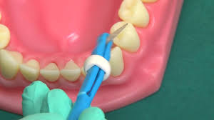 3 Perio Aid Youtube Perio·aid®, ofrece distintas alternativas con concentraciones diferentes de clorhexidina según las necesidades del tratamiento, porque no todos los pacientes son iguales.