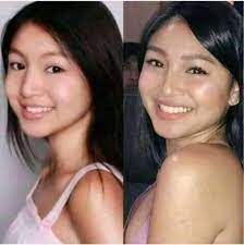 Nadine lustre and kim chiu before. Facebook