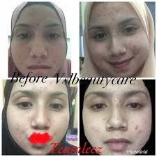 The destination for the very best in beauty, we trawl the globe to create a curated 'hall of fame'. Vsl Beauty Care Terengganu í™ˆ Facebook