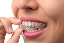 מיישר השיניים- DENTAL GUARDS - קוסמטיקה וטיפוח לאישה