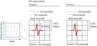The Ecg Leads Electrodes Limb Leads Chest Precordial