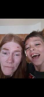 Photo editing request to restore bruised face and change clothing