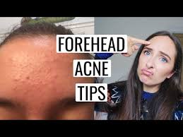 Once the nature of the bump has been determined, your doctor will advise you about how to treat it. Bumps On Forehead Causes Treatments And Preventions Red Hot Bargain
