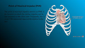 Image result for Point of Maximum Impulse