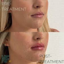 Kyndra Thomas, MSN, APRN (@nofilternp.kyndra) • Instagram photos and videos