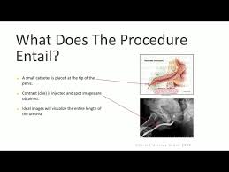 Image result for Voiding Cystourethrogram