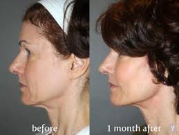 Spa в Норт Бергене на карте рядом со мной: ☆ адреса, время работы, отзывы —  Яндекс Карты