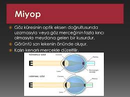 Goz Ve Gozun Yapisi Metin Kilic Ppt Video Online Indir