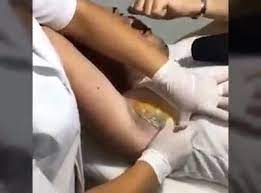 Tj Fernandes Mulher Depilando A Axila Com Cera X Homem